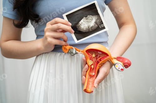 Preview: Woman Holding Ultrasound and Reproductive System Model