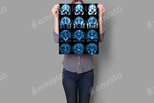 Preview: Hands hold MRI scan of head, neck and brain of patient, holding in hands.