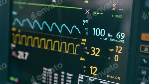 Preview: Medical equipment in hospital modern heart rate monitor in operating room display for monitoring