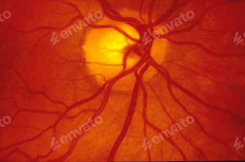 Preview: Human Retina