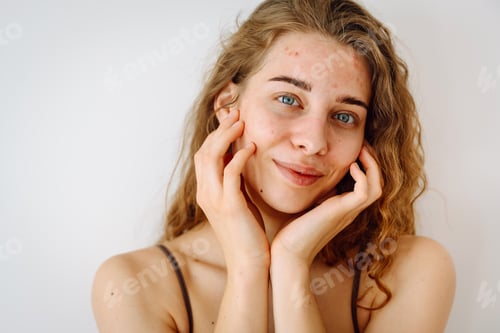 Preview: Cute woman with rashes on her face looks into a small mirror. Natural beauty. Cosmetology, care.