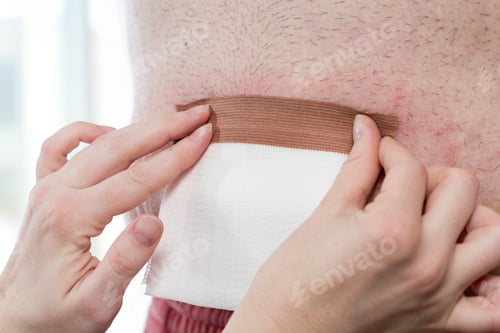 Preview: Nurse dressing the patient's wound