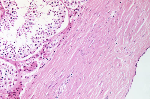 Preview: Testis