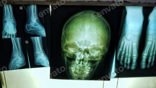 Preview: Xray of human skull and feet