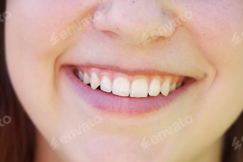Preview: young woman with toothy smile and perfect white teeth