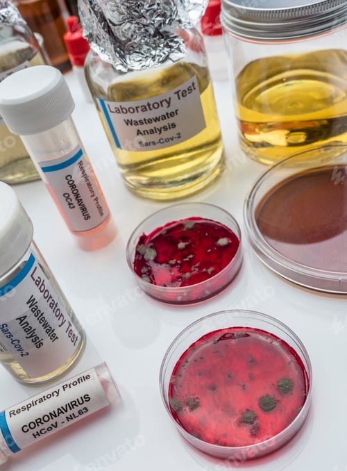 Preview: Bacteriological petri-disk culture with wastewater samples