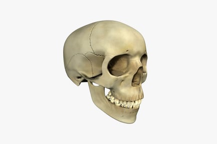 Preview: Lateral view of a cracked human skull