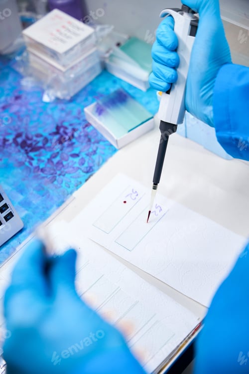 Preview: Laboratory worker makes a general blood test