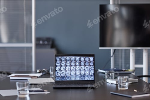 Preview: Neurologists Laptop Showing X Ray Scan of Human Brain on Table at Medical Office