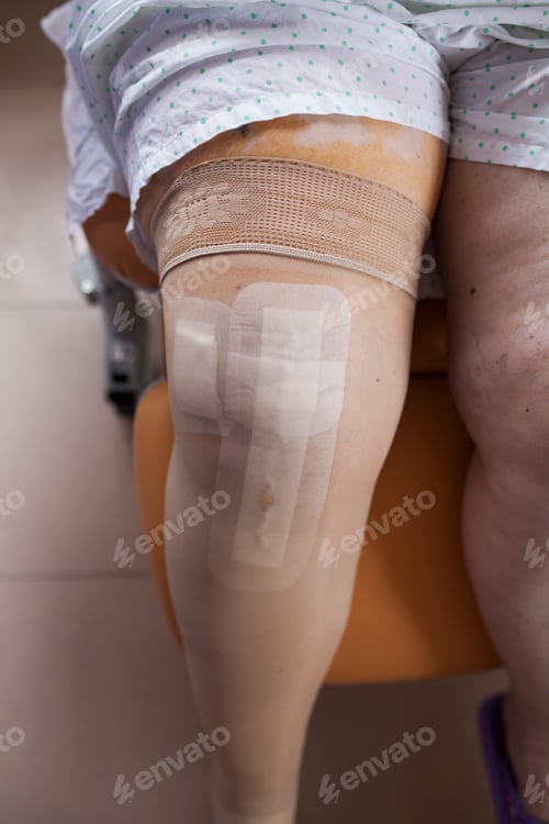 Preview: Mature woman hospitalized