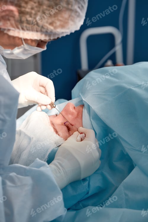 Preview: Close up of the face of a patient who is undergoing blepharoplasty. The surgeon cuts the eyelid and