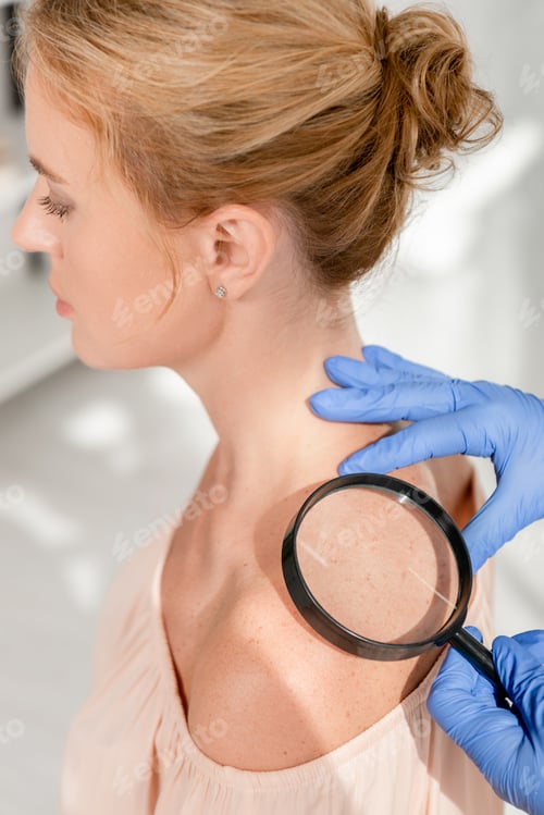 Preview: cropped view of dermatologist examining skin of patient with magnifying glass in clinic