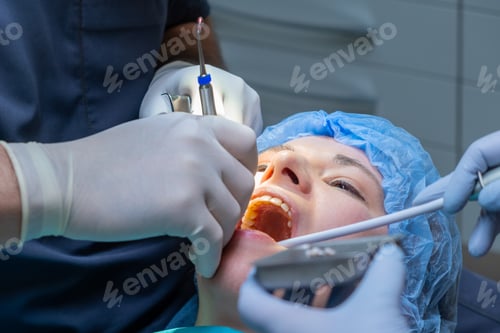 Preview: Dental professional works with forceps performing procedure.