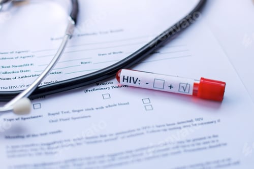Preview: HIV Test Tube With Blood Plasma on Medical Report