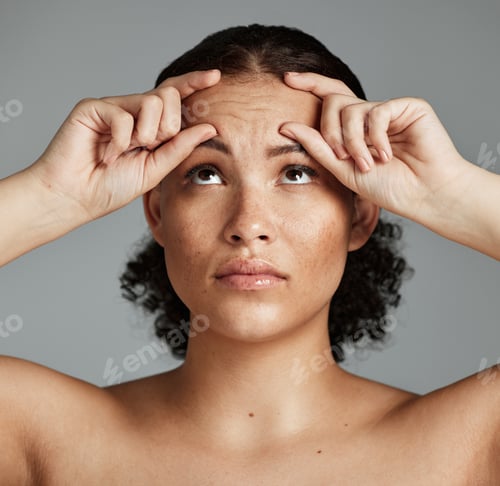 Preview: Face wrinkles, beauty health and anxiety of black woman with wellness facial, botox help and prp. S