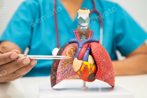 Preview: Pneumonia, lung cancer, Asian doctor holding human model.