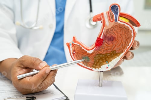Preview: Stomach disease, doctor with human anatomy model for study diagnosis and treatment in hospital.