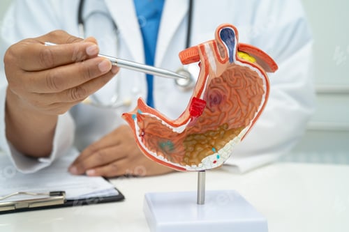 Preview: Stomach disease, doctor with human anatomy model for study diagnosis and treatment in hospital.