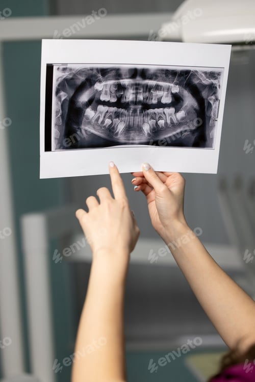 Preview: Beautiful woman doctor with dental scans in hands in a dental clinic