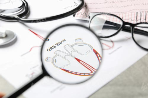 Preview: Medical concept with magnifier and electrocardiogram, close up