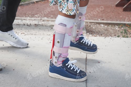 Preview: Child cerebral palsy disability, legs orthosis.