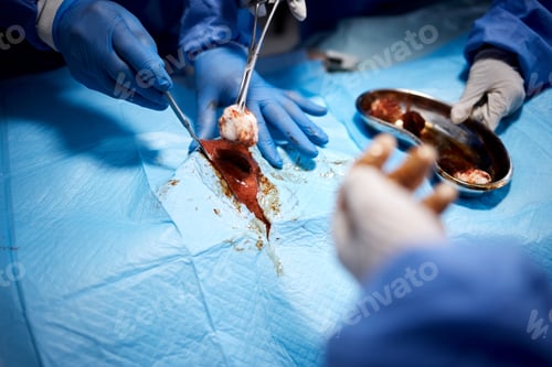 Preview: Medical Professionals Conducting Operation in Sterile Environment