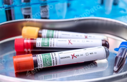 Preview: Blood sample from Ebola patient, positive result, conceptual image
