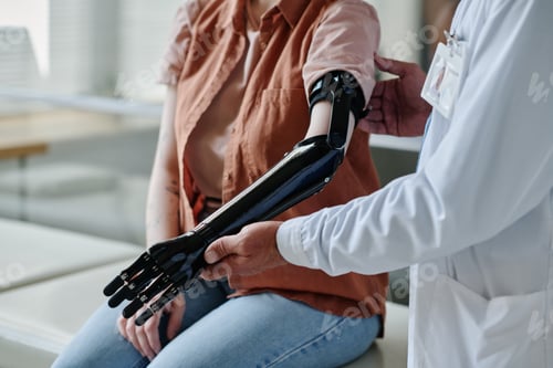 Preview: Close up of doctor fitting mechanical prosthetic arm to young woman