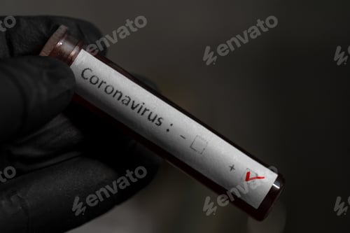 Preview: Coronavirus Positive Test Sample in Gloved Hand