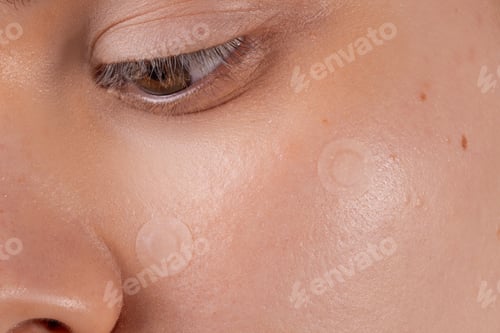 Preview: Girl with acne stick round acne patch on her cheek
