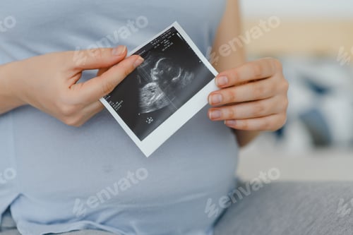 Preview: Pregnant woman is holding her stomach and a photo of her Ultrasound