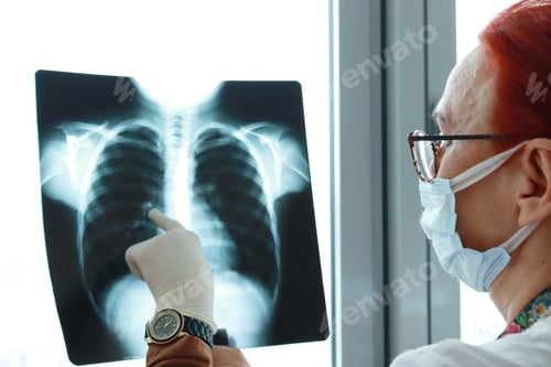 Preview: A doctor analyzes the x-ray of the child's lungs