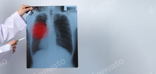 Preview: Asia woman doctor holding and checking up lung’s x-ray film or radiograph from coronavirus pandemic.