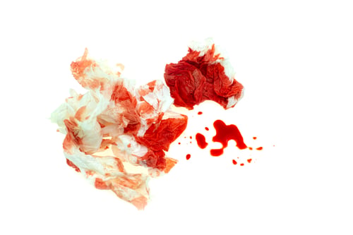 Preview: Used bloody toilet paper