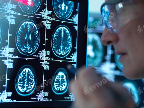 Preview: Doctor viewing brain scans for possible disease or damage in clinic