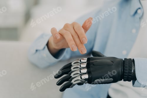 Preview: Disabled female use prosthesis of hand, artificial limb, closeup. Disability, high tech medical care