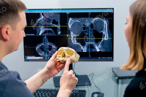 Preview: the radiologist doctor looks at the screen on which the 3D image of the nose scan shows the patient