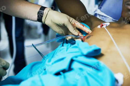 Preview: Medical Team Performing Emergency Procedure on Patient