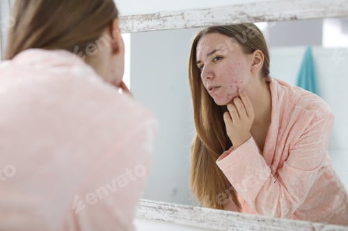 Preview: Young woman with acne problem near mirror in bathroom