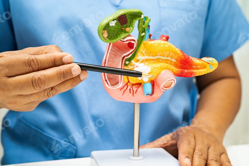 Preview: Pancreatitis, pancreatic cancer, Asian doctor with pancreas, gallbladder