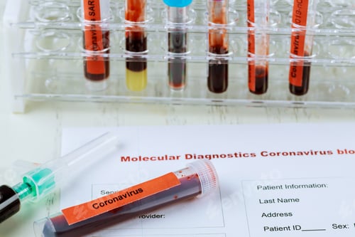 Preview: Blood Sample Corona virus Novel coronavirus 2019-nCoV