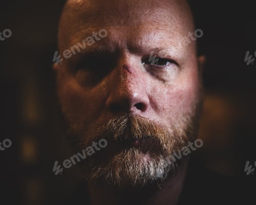 Preview: Portrait of a man with cut on his face