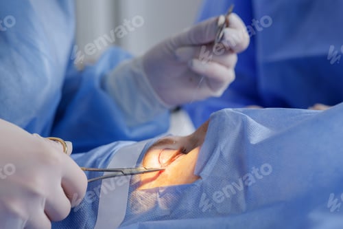 Preview: Upper eyelid blepharoplasty suturing under microscope in a sterile operating room