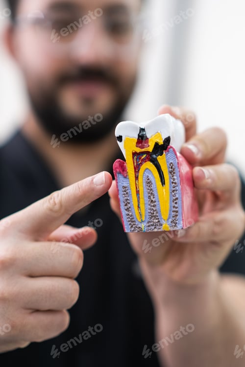 Preview: Dentist pointing to plastic model of human tooth with multiple caries destructive effect