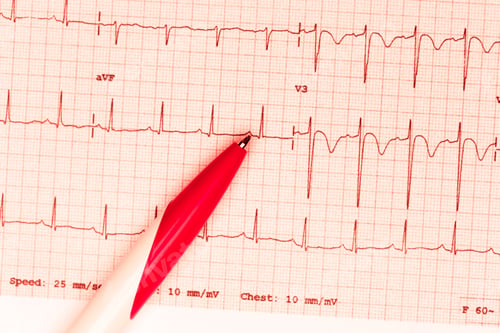 Preview: cardiogram and technical pen