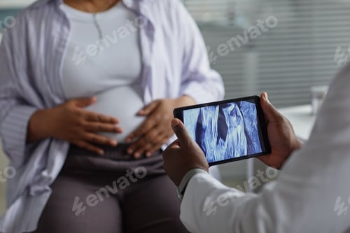 Preview: Pregnant Young Adult Black Woman Undergoing Ultrasound Examination in Clinic