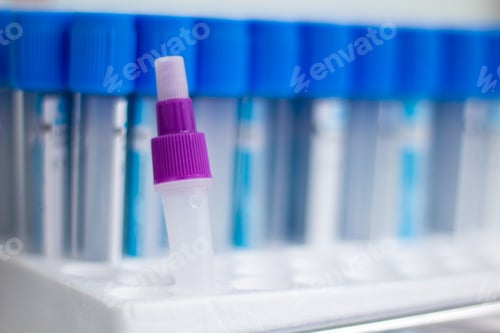 Preview: Selective focus on a test tube with purple cap with other tubes in the background