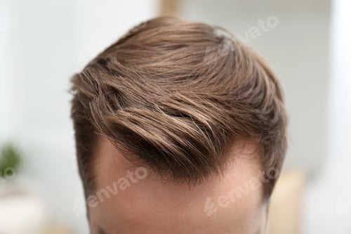 Preview: Young man with hair loss problem indoors, closeup