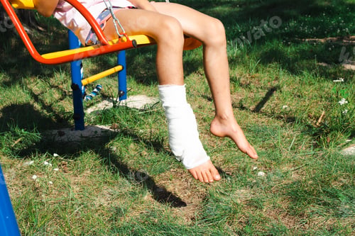 Preview: Children's legs are bandaged in plaster - barefoot on a swing