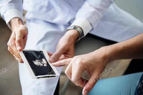 Preview: Pregnant woman having fetal monitoring by doctor